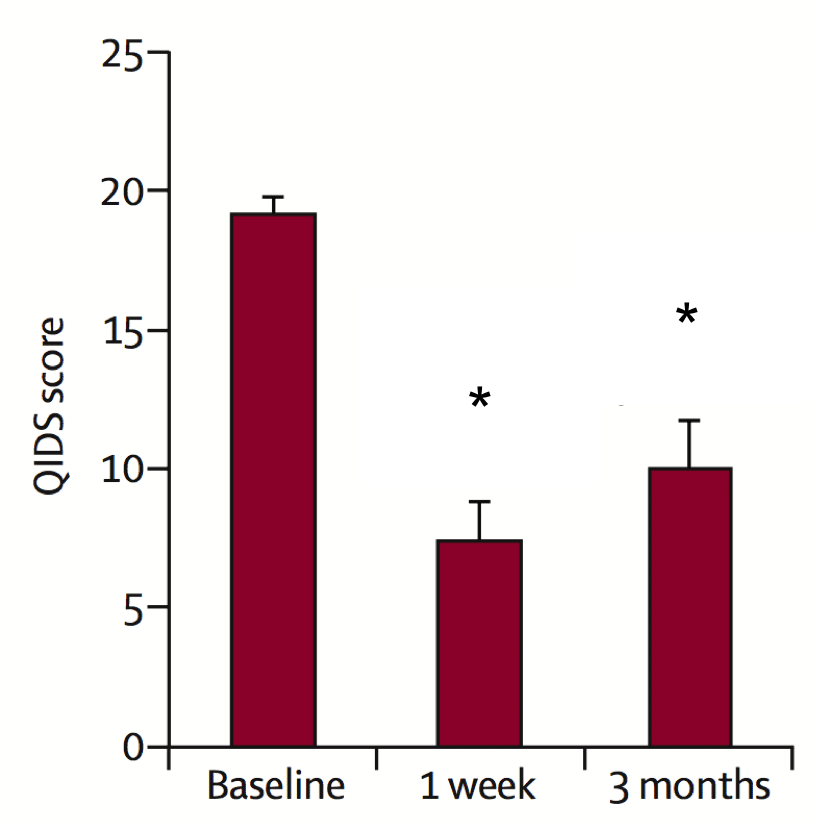 Graph showing that the QIDS Score is at nearly 20 at the baseline, down to around 7 at 1 week, and at about 12 at 3 months.