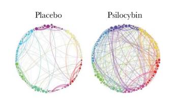 placebo-vs-psilocybin-neuronal-colors