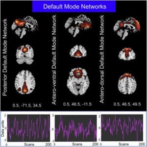 default mode network image